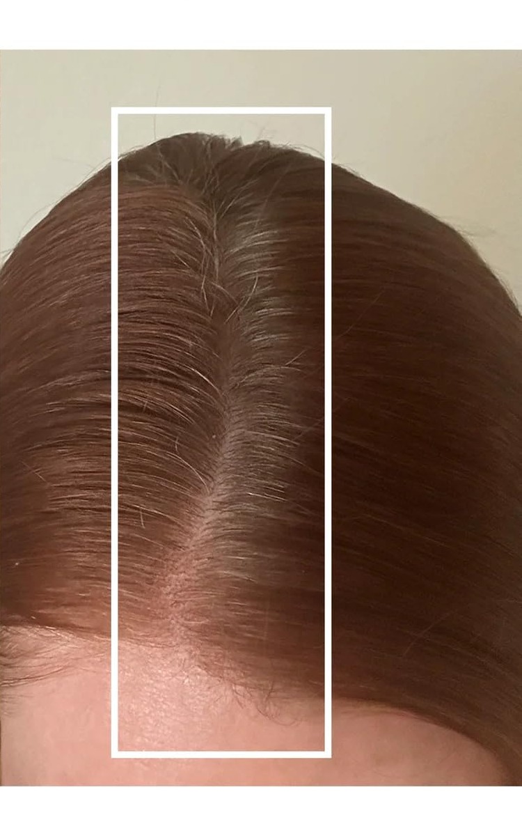 After 16 weeks of Reviru essential therapy